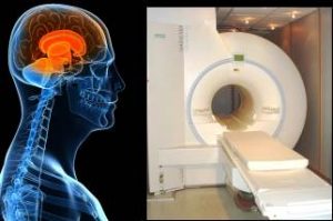 Graphic of skull and a photo of an MRI scanner.
