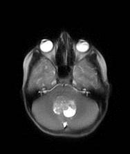 MRI scan of a skull.
