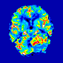 MRI scan of a skull.