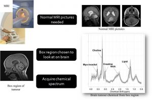 Montage showing MRI scans of a skull, two photos of an MRI scanner and a graph.