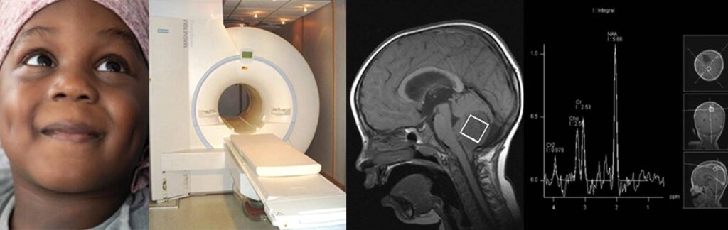Child with cancer, MRI scanner, MRI scan of a brain and scan results graph